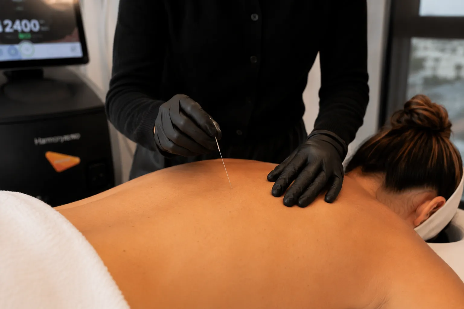 Dry Needling — טיפול כאב נקודות טריגר (דיקור יבש - Dry Needle)
