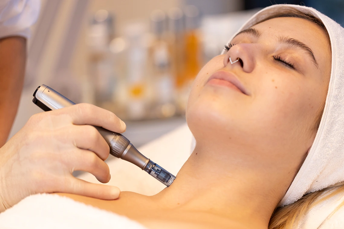 Microneedling — חבילת 3 סשנים (מיקרונידלינג)
